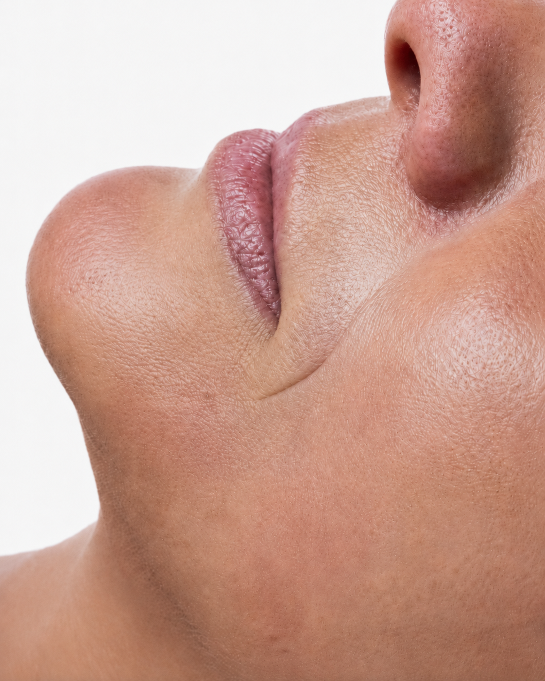 Resultado de Manchas perioral: Contorno de labios mas parejo y luminoso
